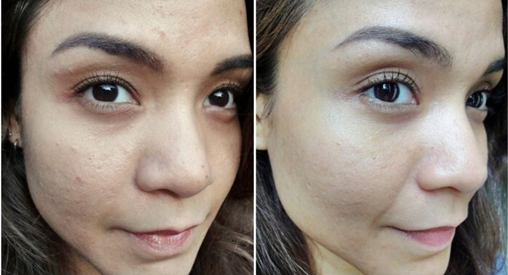 MASAJEADOR FACIAL LED REDUCTOR + SUERO ANTIOXIDANTE VITAMINA C