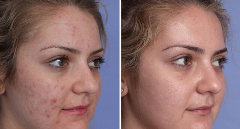 MASAJEADOR FACIAL LED REDUCTOR + SUERO ANTIOXIDANTE VITAMINA C